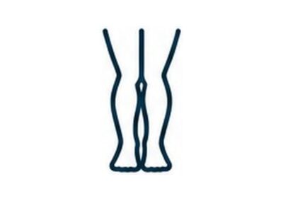 VALGUS
